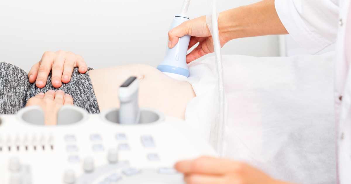 Ultrassom Obstétrico: Acompanhe Cada Etapa da Sua Gestação com Segurança