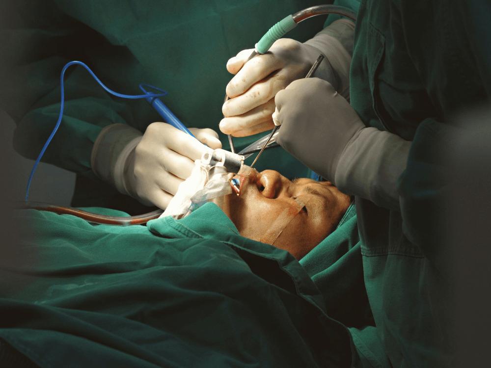 Como é feito cirurgia a laser 